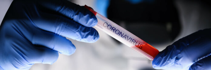 Coronavirus: So informierst du dein Personal richtig